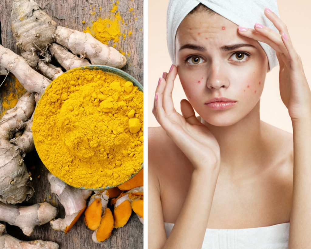 Estos son los beneficios de la cúrcuma para nuestra piel - collage-mascarillas-de-curcuma-0-1024x819
